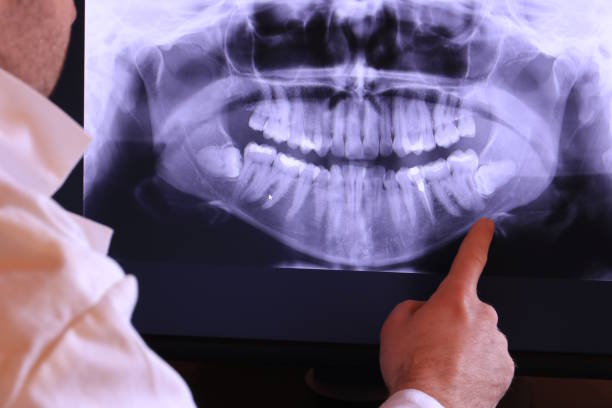 Best Urgent Care for Lost Fillings or Crowns in Twisp, WA